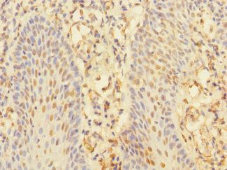 CHRNA10 Antibody