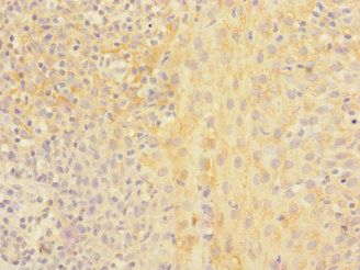 CHRNA2 Antibody