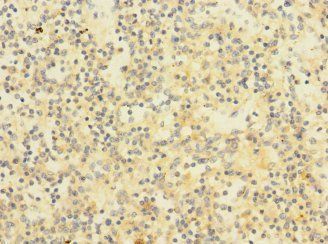 CHRNA2 Antibody