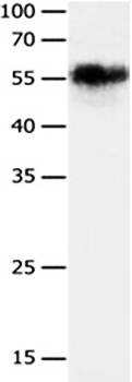 CHRNA3 Antibody