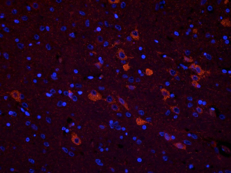 CHRNA7 antibody
