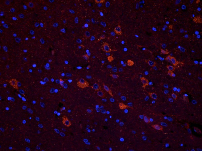 CHRNA7 antibody