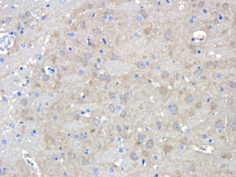 CHRNA7 antibody