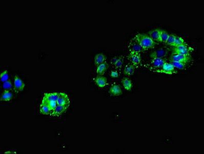 CHRNB1 antibody