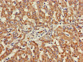 CHRNB1 antibody