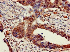CHRNB1 Antibody