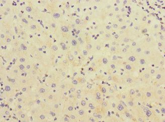 CHRNE antibody