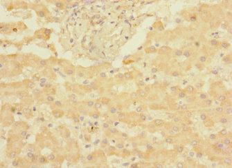 CHRNE antibody