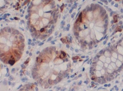 Rabbit Human Chromogranin A Antibody