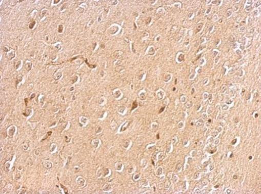Chromogranin C antibody