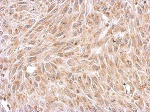 Chromogranin C antibody