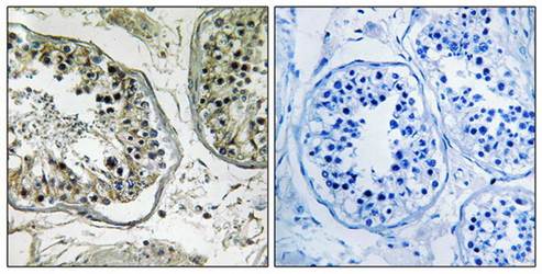 CHST13 Antibody