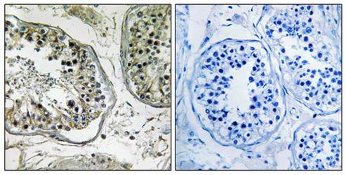 CHST13 antibody