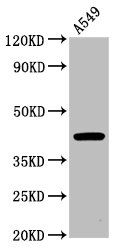 CHST14 antibody