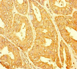 CHTOP Antibody