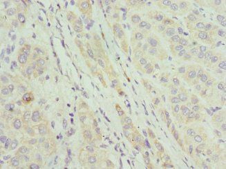 CIAPIN1 Antibody