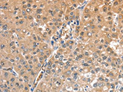 CIAPIN1 Antibody