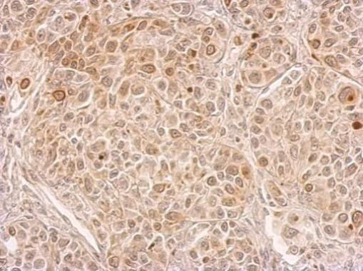 CIAPIN1 antibody