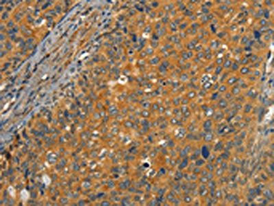 CIB1 Antibody