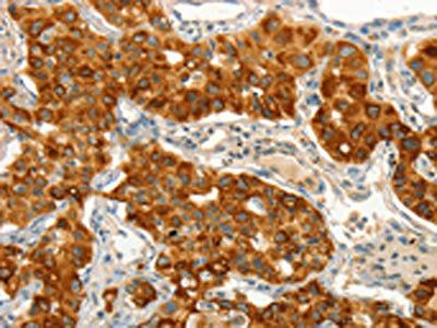 CIB1 antibody