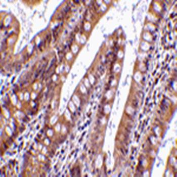 CIDE-B Antibody