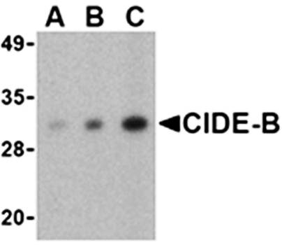 CIDE-B Antibody