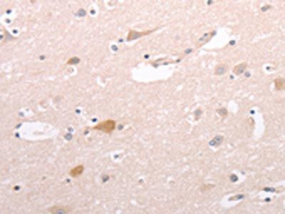 CIDEB Antibody