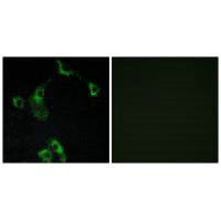 CIDEB antibody