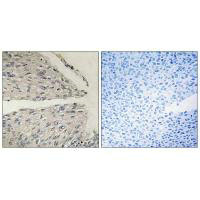 CIDEB Antibody