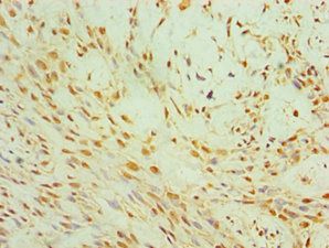 CIDEC Antibody