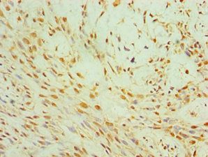 CIDEC antibody