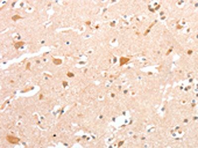 CIDEC Antibody