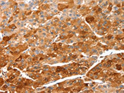 CIDEC Antibody