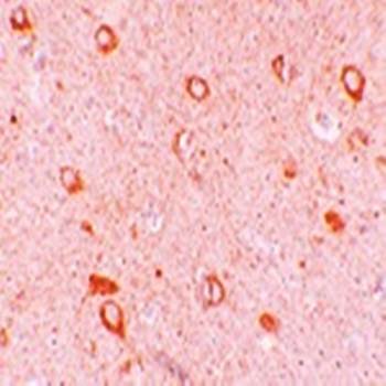 CIITA Antibody