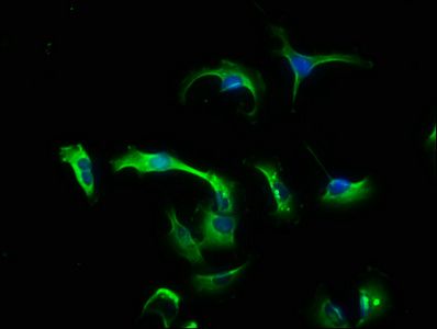 Ciliary neurotrophic factor antibody