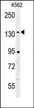 CILP2 antibody