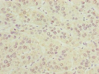 CIPC Antibody
