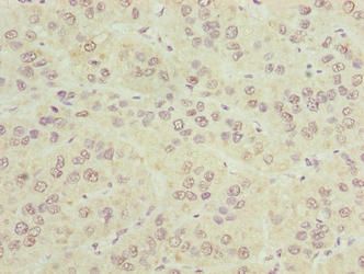 CIPC antibody