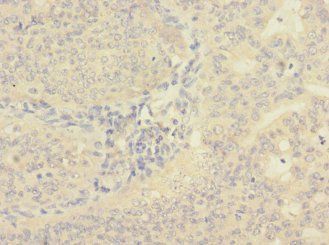 CIR1 Antibody
