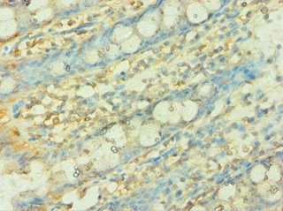 CISH Antibody