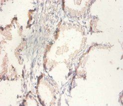 Citrate synthase, mitochondrial antibody