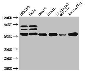 Citrate synthase, mitochondrial antibody