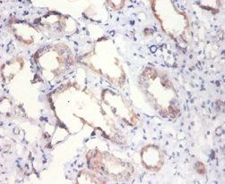 Citrate synthase, mitochondrial antibody