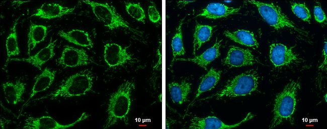 Citrate synthase antibody [N2C3]