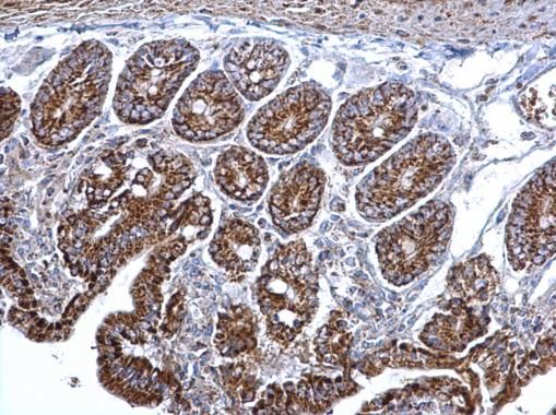 Citrate synthase antibody [N2C3]