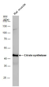 Citrate synthetase antibody