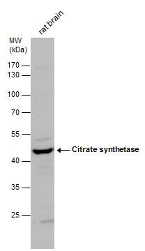 Citrate synthetase antibody