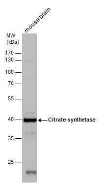 Citrate synthetase antibody