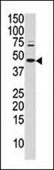 cJun (phospho-Ser63) antibody