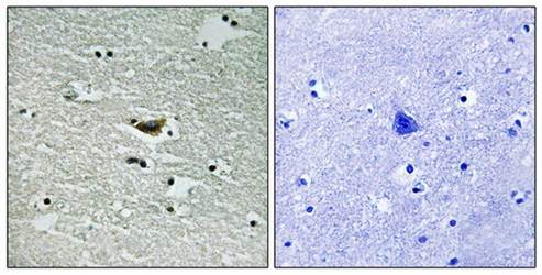 CK-1α (Phospho-Tyr294) Antibody